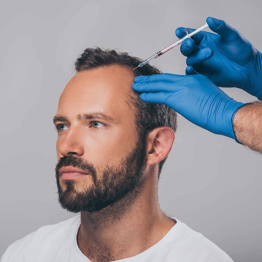 PRP hair treatment